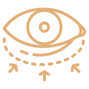 Blefaroplastia