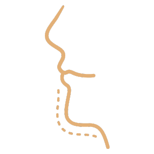Mentoplastia